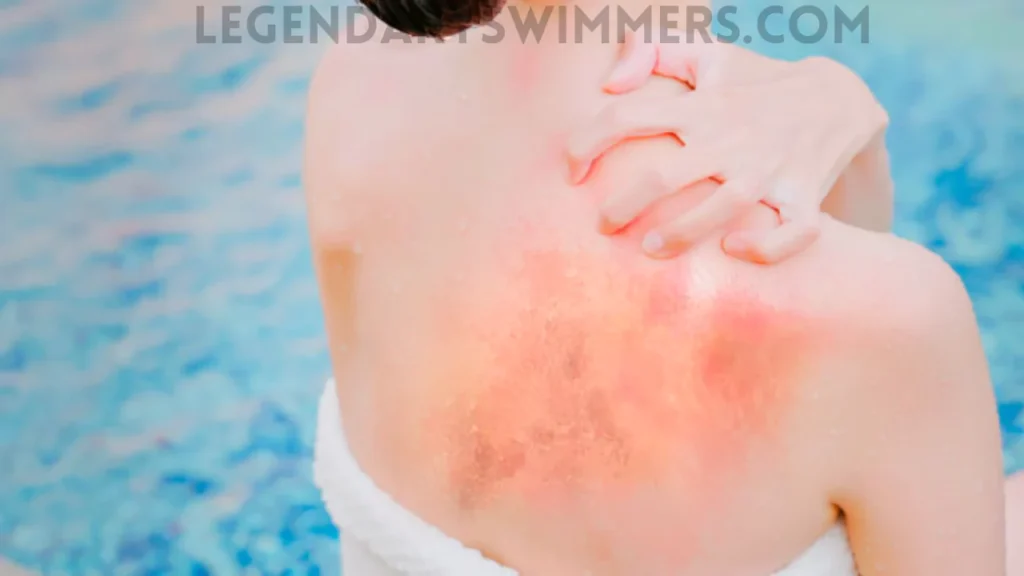 Eczema and Swimming: Top Tips for Clear Skin